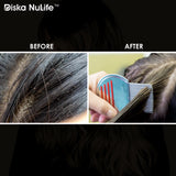 Diska Nulife Nit Free Lice Comb | Professional Stainless Steel Louse and Nit Comb - Colors May Vary